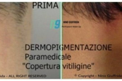 dermopigmentazione paramedicale