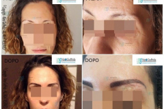 Micropigmentazione  correttiva sopracciglia