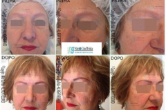 TRUCCO SEMIPERMANENTE SOPRACCIGLIA