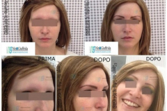TRUCCO SEMIPERMANENTE SOPRACCIGLIA