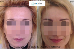 TRUCCO PERMANENTE SOPRACCIGLIA