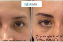 MICROBLADING SOPRACCIGLIA