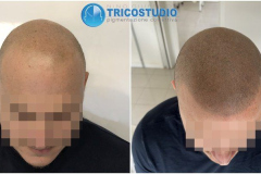 effetto-rasato