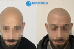 effetto-rasato