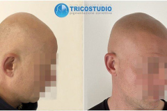 effetto-rasato