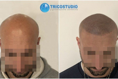 effetto-rasato