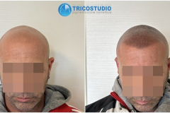 effetto-rasato