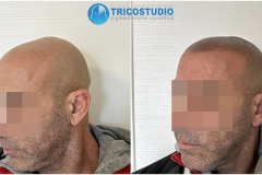 effetto-rasato