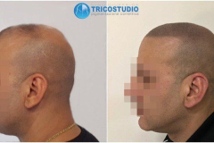 effetto-rasato-effetto-densita
