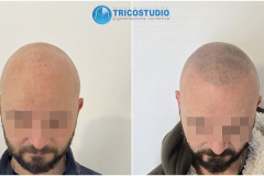 effetto-rasato