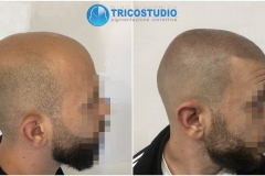 effetto-rasato